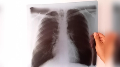 Röntgenbilder sind zu schade für die Restmülltonne. (Foto: Kommunale Abfallwirtschaft)