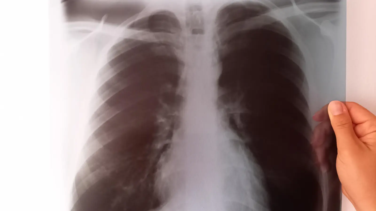 Röntgenbilder sind zu schade für die Restmülltonne. (Foto: Kommunale Abfallwirtschaft)