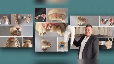 Andreas Ell, stellvertretender Obermeister der Südbayerischen Zahntechniker-Innung, mit seinem Meisterstück. (Foto: SZI)